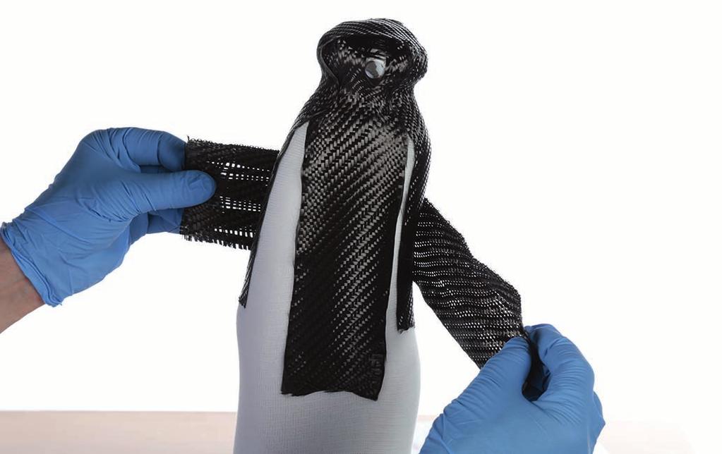 laterálnímu kondylu. Obnažte laminační pomůcku ventilu.