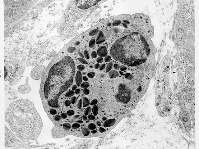 Eosinofilní granulocyt 2-4% Velikost 12-15μm Dvoulaločnaté jádro Specifická granula: krystalická dřeň (internum) hlavní bazický protein