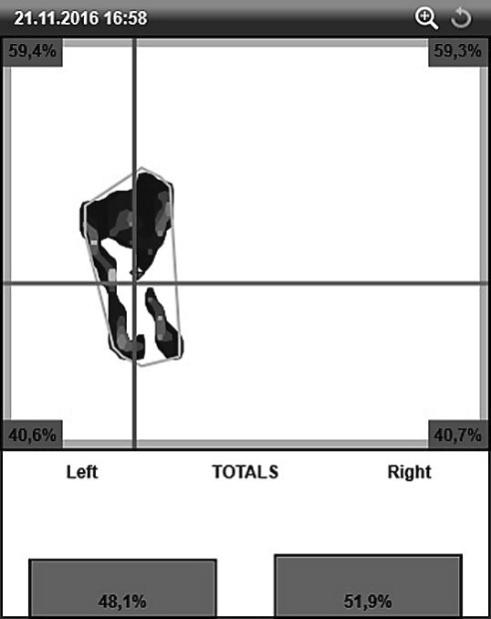 tlakový profil a rozložení hmotnosti tlakový profil a rozložení hmotnosti délka trajektorie CO 69,36 cm plocha 95% konfidenční elipsy 7,61 cm 2 délka