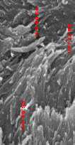 tropocollagen helical subnanofibrils, but also on the sides of the collaterally oriented collagen subnanofibrils. Hydroxylapatite crystals are remarkable by two phenomena, i.e. the piezoelectricity (i.