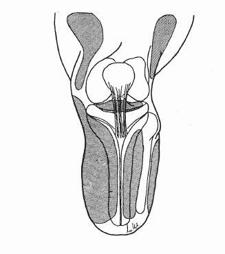 Obrázek 4: Nezatížitelné oblasti bércového pahýlu (šedé plochy). (Kaphingst, 2002) Z biomechanického hlediska musí lůžko splňovat několik zásad.