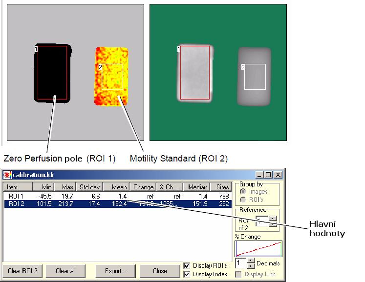 10. Statistická hodnota střední hodnoty perfuze mean perfusion pro dvě oblasti zájmu oblast region ROI 1 (Zero Perfusion Area) ROI 2 (Motility Standard) střední hodnota