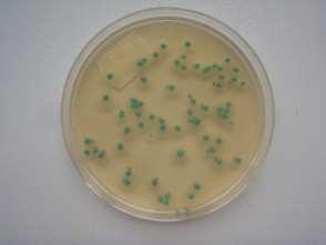 Listeria monocytogenes Byla stanovena ve 100 ml vzorku na