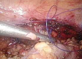 The nerves showed on figure 1 are clearly visible. Obr. 3.