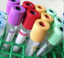 Pátrať po príčine Ak pretrváva nevysvetlená bolesť > 1 mesiac Ak bolesť nereaguje na bežnú analgetickú liečbu Ak sa bolesť zvýrazňuje Ak je kľudová, nočná