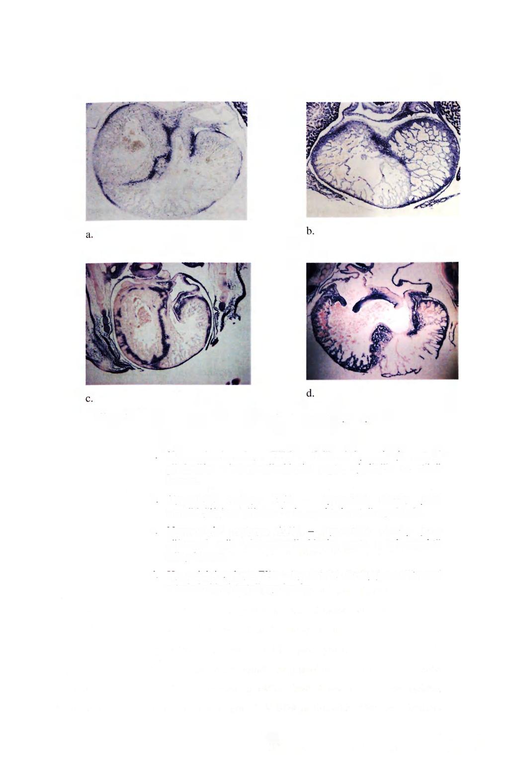 Obr. 5: Transverzální řez komorami při značení Hypoxyprobe a. Normoxické embryo ED6 - tkáňová hypoxie je patrná především v interventikulárním septu, ojediněle ve stěnč komor. b.