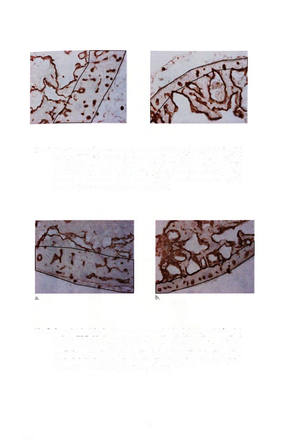 a. b. Obr. 6: Srovnání tloušťky levé komory u normoxického (a.) a hypoxickcho (b.) embrya ED5. Na řezech je patrný rozdíl v tlouštce stěny a zvýšená trabekularizace u hypoxických embryí.