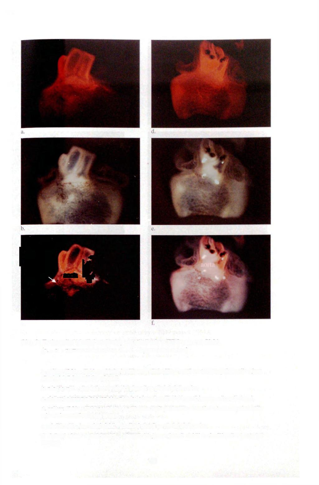 ti J á aorta L mm v * c. Obr. 9: Znázornění hladké svaloviny ve stěně cév u ED8 pomocí SMA (a. - c. - normoxické srdce, d. - f. - hypoxické srdce) a.