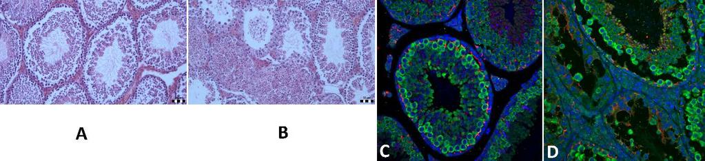 Výsledek 5: Samčí neplodnost indukovaná v prostředí diabetes transgeneračním přenosem Diabetické prostředí ovlivňuje reprodukční parametry u myší proti kontrole.