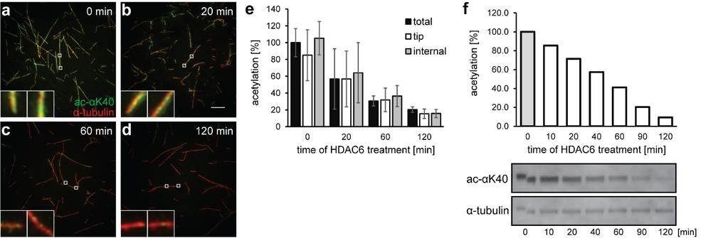Výsledek 6: Lidská histondeacetylasa 6 preferenčně deacetyluje volné dimery tubulinu a ne mikrotubuly Rukopis popisuje detailní kinetickou analýzu deacetylace tubulinu a interakcí mezi HDAC6 a