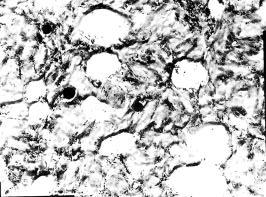 patterns ofthe precipitates from Fig. 9. TEM.