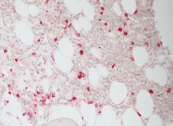 morphology  mitotickej