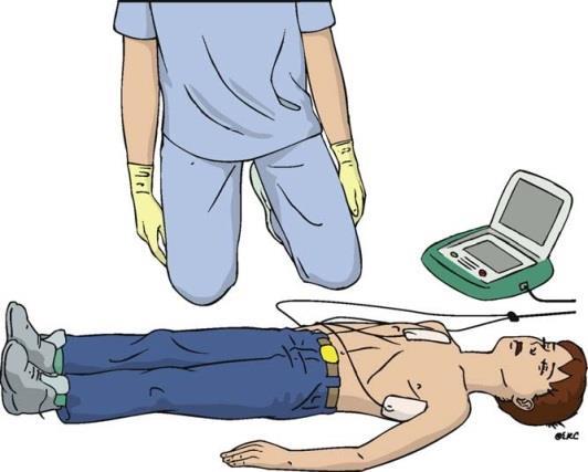 Automatické externé defibrilátory bezpečnosť a