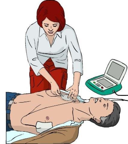 Defibrilácia detí Veľkosť elektród: 4,5 cm priemer: dojčatá a deti < 10 kg 8-12 cm priemer: > 10 kg (staršie ako 1 r.