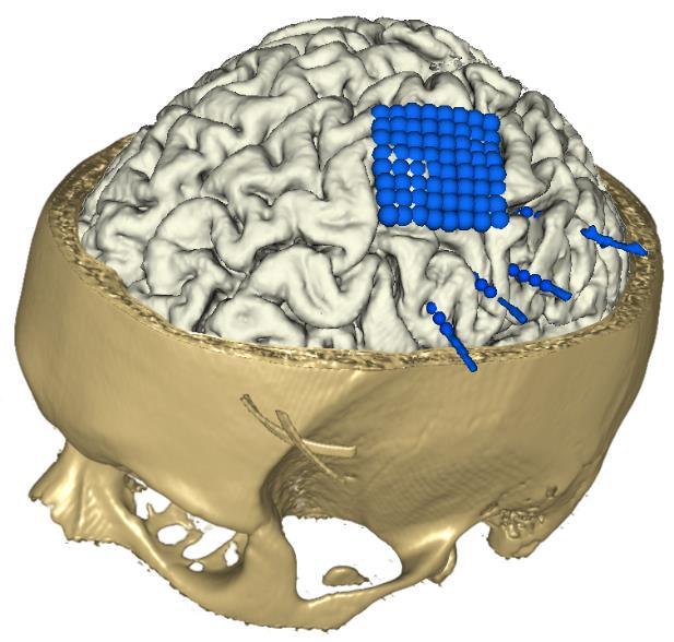 Příčiny, průběh a závažnost nemoci jsou různorodé, avšak společným rysem je vznik spontánních epileptických záchvatů [1].