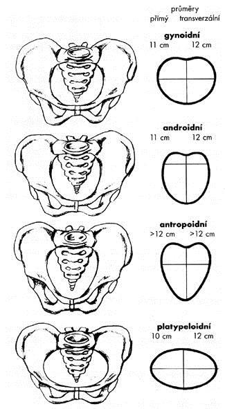 Typy pánve gynoidní kruhový vchod androidní srdčitý vchod anthropoidní ovalný vchod,