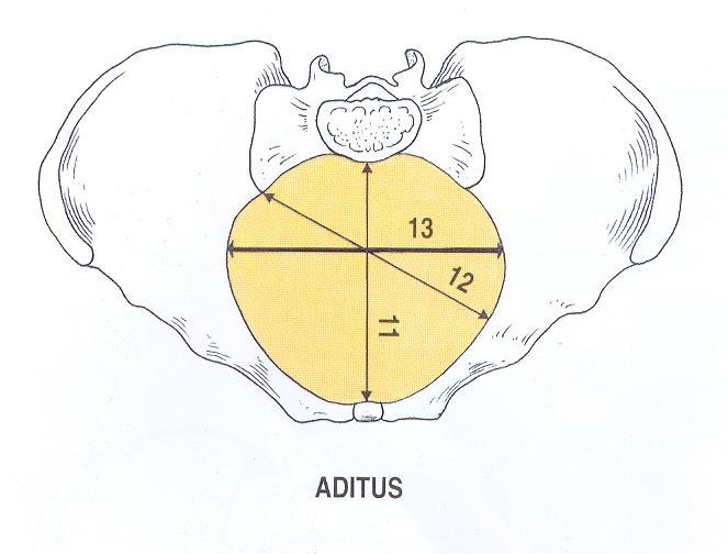 = linea terminalis Pánevní vchod diameter recta (conjugata anatomica): promontorium horní okraj symphysis pubica = nejméně 11 cm diameter obliqua: