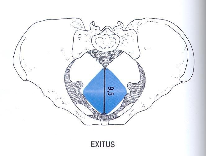 Pánevní východ = dvě trojúhelníkové roviny (trigonum urogenitale et anale) dolní okraj symphysis pubica tubera ischiadica os coccygis diameter transversa: mezi tubera ischiadica = nejméně