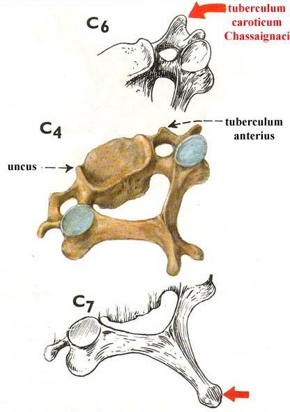 Další obratle C VI výrazné tuberculum anterius = tuberculum