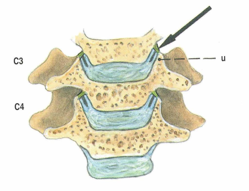 Articulationes uncovertebrales Hákoobratlové klouby mezi uncus corpois
