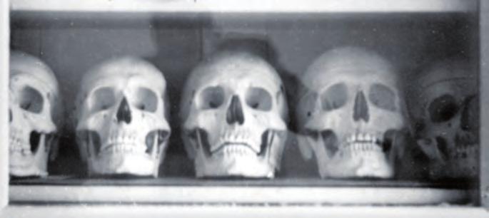 Podle rozhodnutí vedení Gestapa měly hlavy dvou přímých vykonavatelů atentátu, Gabčíka a Kubiše, zůstat se zachovanou tváří.