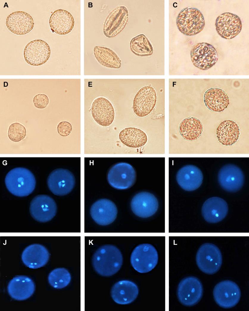 Obr. 4: Příklady fenotypových defektů mutantních pylových zrn huseníčku ve světlém poli (A-F) a při užití fluorescence (G-L).