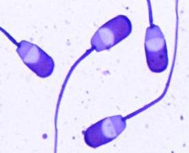 případného výskytu různých abnormalit spermií. Výběr vhodné metody barvení má nezastupitelnou roli, neboť ne každá metoda je vhodná pro zvolený druh zvířat nebo člověka.