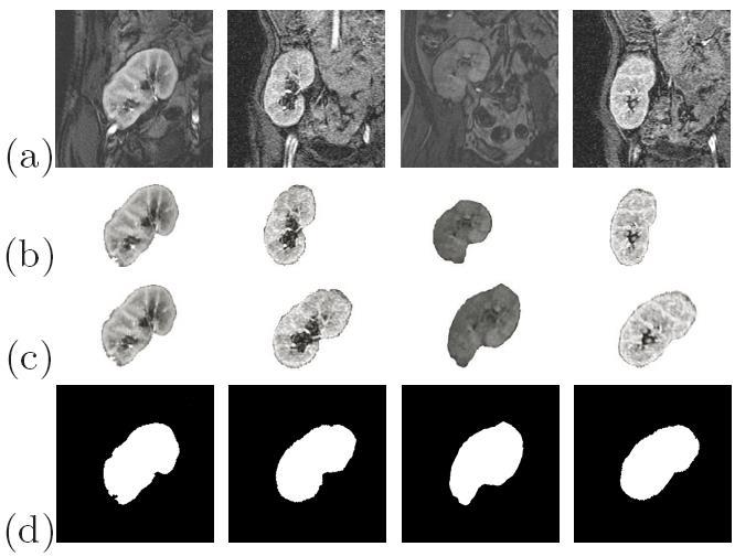 Obr. 3.3: Originál snímek (a), ruční segment (b), zarovnané snímky (c), binární obraz (d), (převzato z [14]) Poslední částí prvního kroku je vytvoření masky ledviny. Na obr. 3.4.a je zobrazena vyznačená část, která vznikne seskládáním všech zarovnaných snímků na sebe.