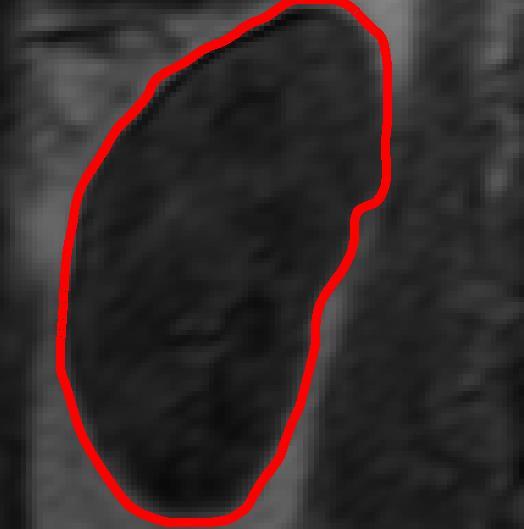 72