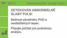 stranu 13). Toto použití umožní interpretaci úplných tvarů pulsových vln (viz příklad níže).