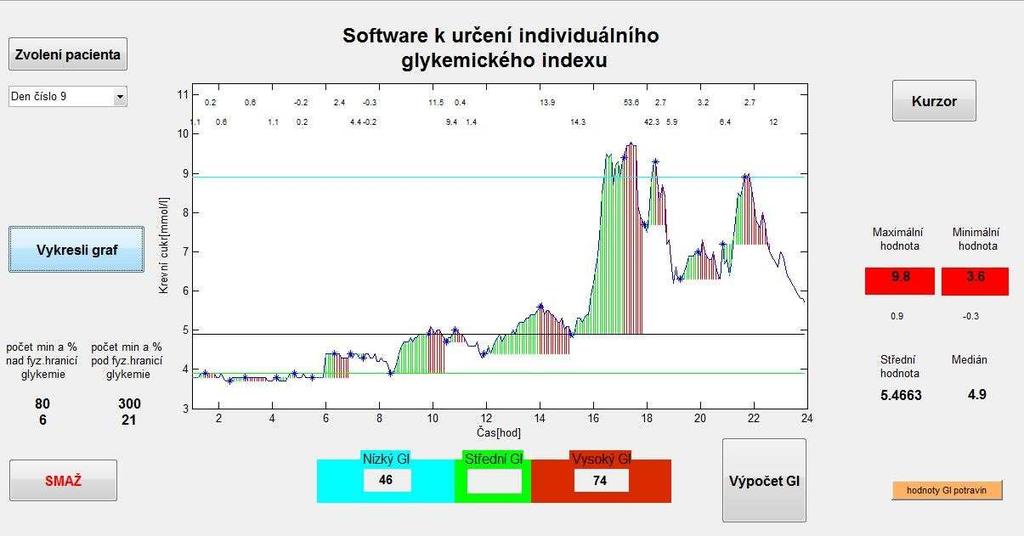 7 Testovaní software na změřených datech Pro testování software byli náhodně zvoleni tři pacienti a u každého z nich byly zvoleny dva dny.