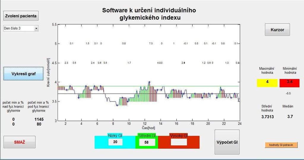 7.2 Test pacienta č. 1(den 3) V obr. 6-2 byl zvolen jiný den stejného pacienta.