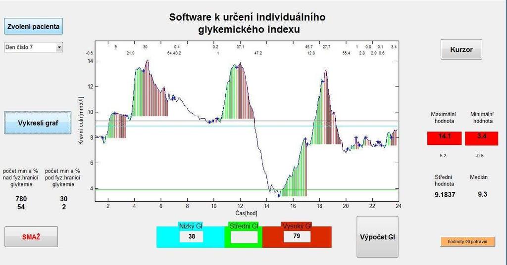 7.6 Test pacienta č. 3(den 7) Na obrázku 6-6 je zobrazen průběh grafu stejného pacienta ale jiný den než na obrázku předchozím.