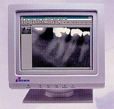 Přímá digitální zubní radiografie Obrazový