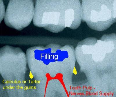 Snímky jednotlivých zubů Lze