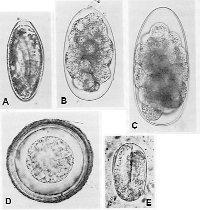 Obrázek č.1: Vajíčka hlístic v trusu koně (http://www.ifauna.cz) A roup B velký strongylid C malý strongylid D škrkavka E strongyloides 6.2.