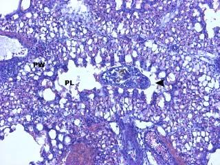 platyrhynchos - rozsáhlý zápal 2 bronchů spojený s edémem a hemoragiami v dutině bronchu, parabronchiální hemoragie, alveolární hyperplazie