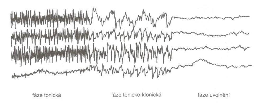 Fakultní základní škola Olomouc, Hálkova 4 19 7.2.