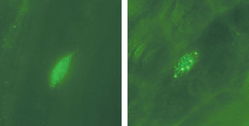 6 Fytochrom funguje v jádře aktivuje transkripční faktory. Je však lokalizovaný původně v cytoplazmě => musí být přemísťěn do jádra.