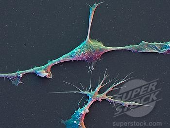 (1) ÚVOD 1.1) Receptor DCL-1 Receptor DCL-1 (v CD systému zařazený pod indexem CD302) byl objeven zcela náhodou M.