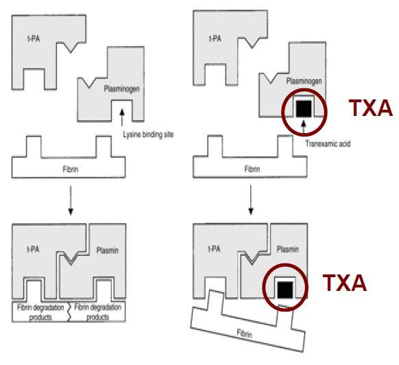 TXA