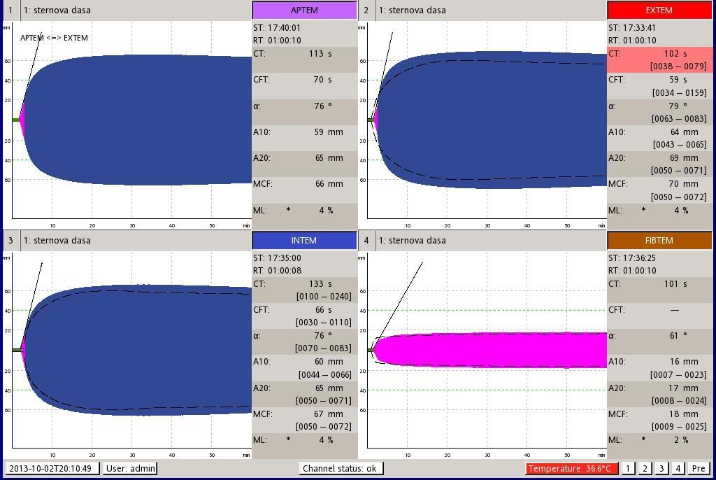 EXTEM: CT 102s