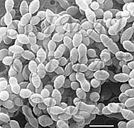 Obr. 5 a 6: Streptococcus salivarus ssp. thermophilus (Kaláb, 2007) 3.4 Zdravotní aspekty Mezi základní funkce probiotik a tedy i BMK patří dietetická a ochranná funkce.