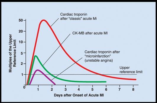 Při použití vysoce senzitivních troponinů(hs ctnt, hs ctni) je důležité nezapomínat na: Klinický stav