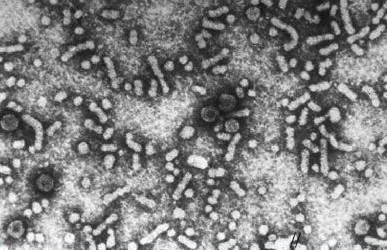 Virus hepatitidy B čeleď