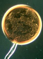 Oddělení: GLOMEROMYCOTA Třída: GLOMEROMYCETES arbuskulus, chlamydospora recentně až na úrovni samostatného oddělení jsou hodnoceny houby z dřívějšího řádu