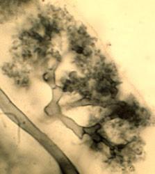 org/glomeromycota cévnatých rostlin arbuskulární mykorhizu (dříve vezikulo-arbuskulární = VAM; má ji asi 80 % cévnatých rostlin): mycelium proniká do