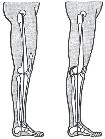 Obr. č. 5 Postavení kolenního kloubu (semiflexe, hyperextenze) (Kapandji, 1970) 2.