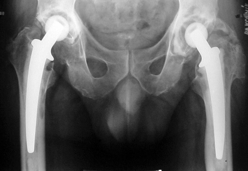 274/ Acta Chir Orthop Traumatol Cech. 84, 2017, No. 4 PŮVODNÍ PRÁCE Tab. 1.