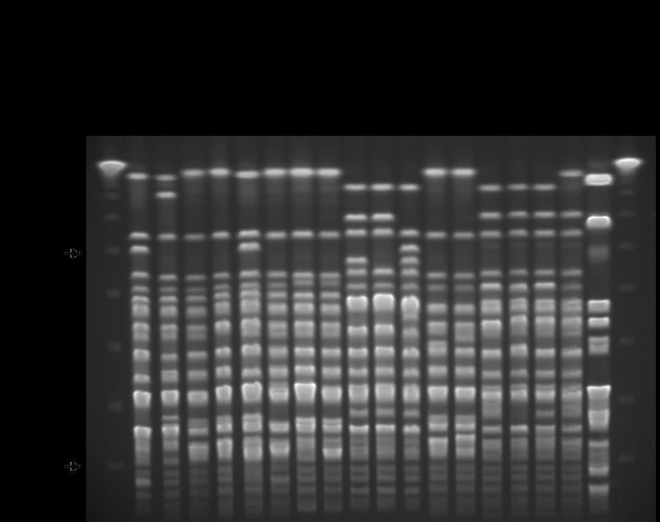 Obr. 5. Makrorestrikční profily genomové DNA (pulzotypy) u studovaných izolátů A. baumannii. Klasifikace do typů (A-E) a jejich případných subtypů (1-5) byla provedena podle Tenovera et al. (1995).